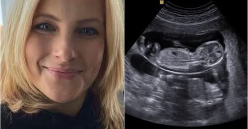 MOST ÉRKEZETT! Várkonyi Andi eloszlatta a pletykákat és bejelentette a hírt. EZ most váratlanul ért mindenkit: